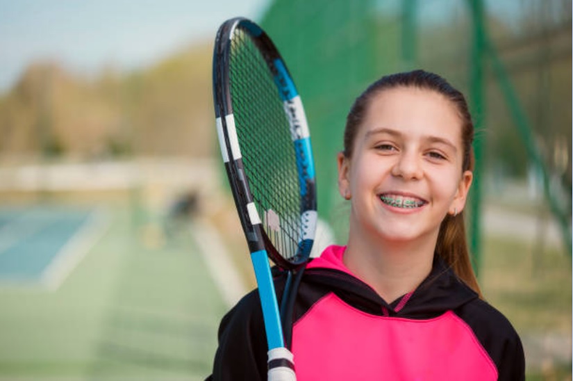 Брекеты и спорт: Как поддерживать активный образ жизни с ортодонтическими устройствами?
