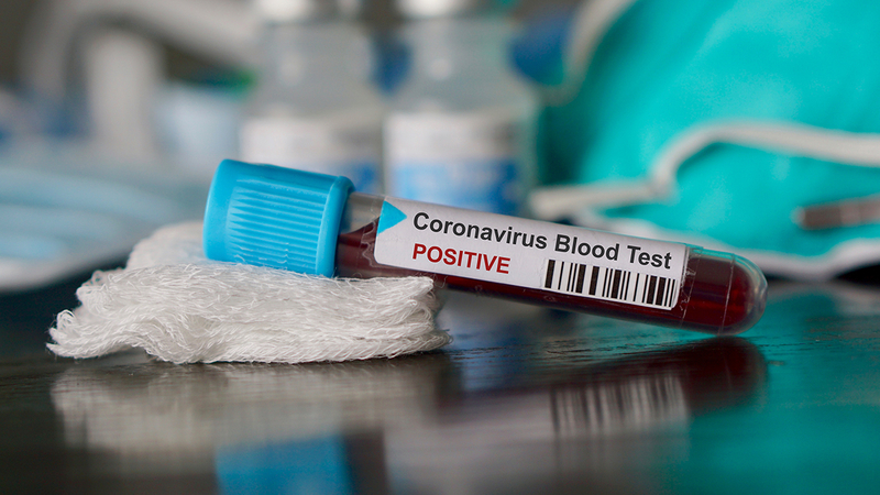 В Харьковской области - 49 новых случаев коронавируса, всего - 3 082